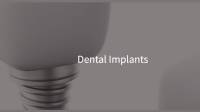 Dental Implants