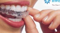 Invisalign