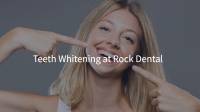 Teeth Whitening